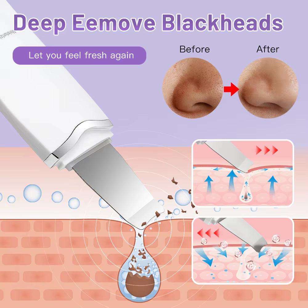 Ultrasonic Peeling Machine Skin Care Blackhead Remover Device Face Cleaning Pore Cleanser Facial Lifting Massager Skin Scrubber